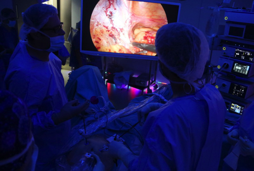 1. intervencio cancer prostata