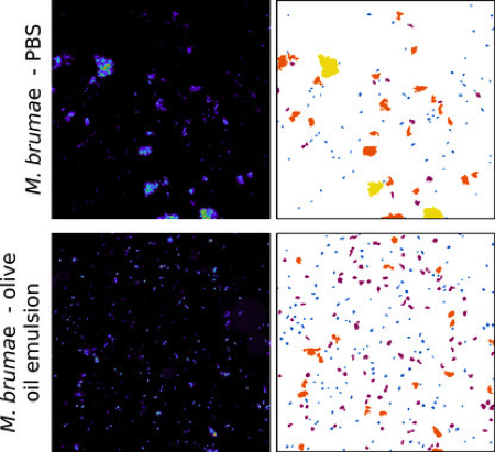 Aceite-de-oliva-y-micobacterias-mejoran-el-tratamiento-del-cancer-de-vejiga_image_380