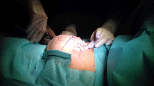 Braqui_1.jpg_1239822799