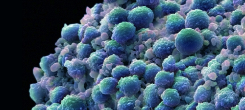 cellula-cancer_974312703_9499600_900x406