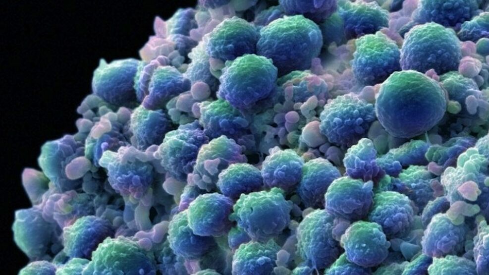 cellula-cancer_974312703_9499856_987x555