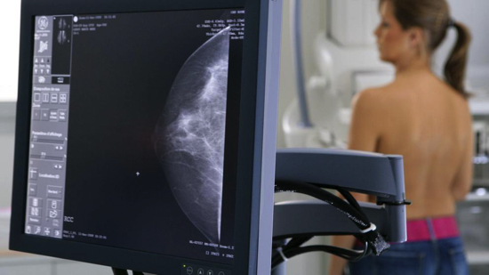 Les mamografies periòdiques faciliten el diagnòstic precoç i redueixen la probabilitat que el càncer evolucioni cap a les metàstasis (Media for Medical / Getty)