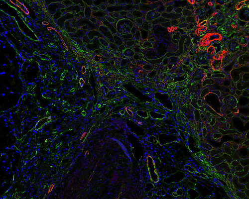 jornada cancer environment