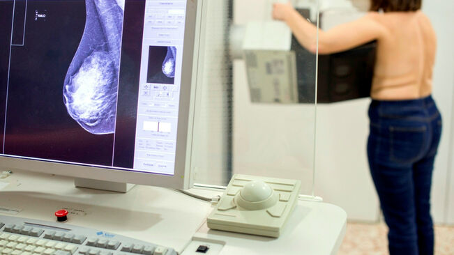 mamografia-hospital-Institut-Assistencia-Sanitaria_2225187667_62389813_651x366