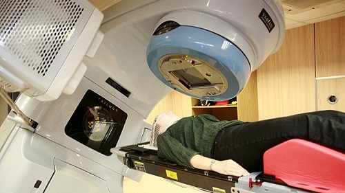 radioterapia_1