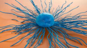 immunoterapia-cancer-cervix-metastatic