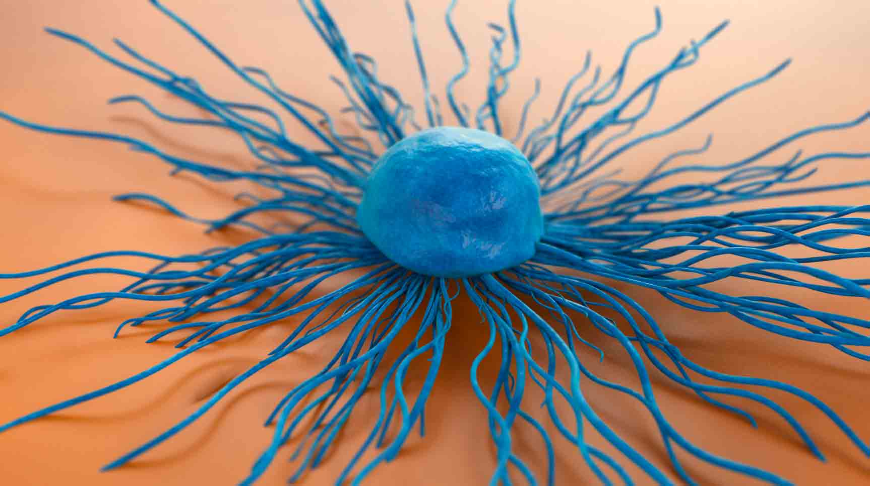 immunoterapia-cancer-cervix-metastatic